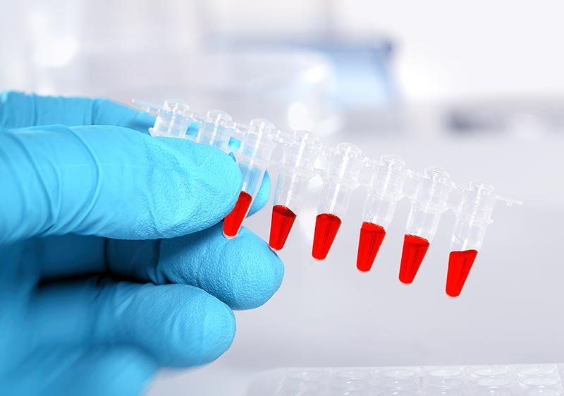 laboratory for allergy test